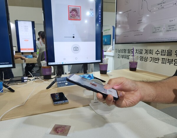 라이프시맨틱스가 개발한 피부암 진단 AI 솔루션 모습. /김동원 기자