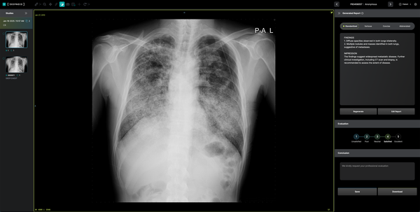 딥노이드의 딥젠 적용 화면 /딥노이드.