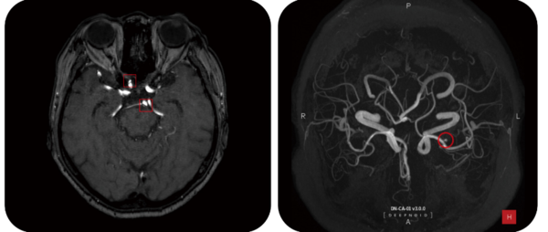 딥노이드의 딥뉴로(DEEP:NEURO) 판독화면 /딥노이드.