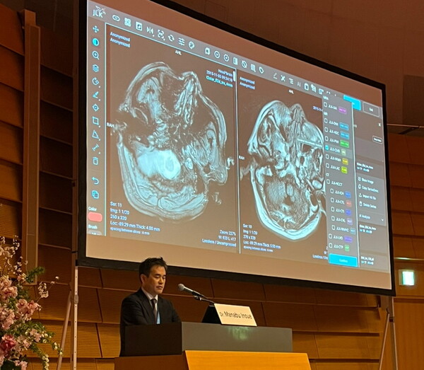 지난달 이노우에 마나부 일본 국립뇌심혈관센터 교수가 일본 오사카에서 개최된 STROKE 2025 JAPAN에 참여해 일본 의료진을 대상으로 JLK 뇌졸중 AI 솔루션 적용 사례를 발표하고 있다. /제이엘케이
