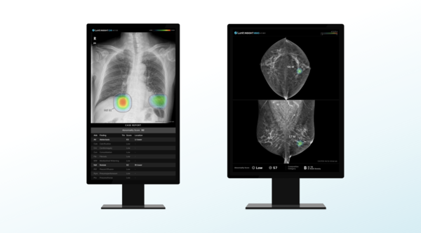 루닛 흉부 엑스레이 AI 영상분석 솔루션 '루닛 인사이트 CXR'(왼쪽)과 유방촬영술 AI 영상분석 솔루션 '루닛 인사이트 MMG' /루닛.