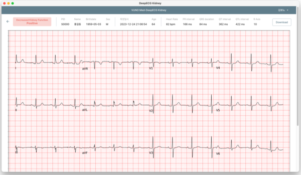 DeepECG Kidney 운영화면 /뷰노