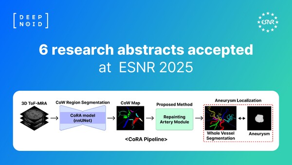 윌리스 고리(대뇌동맥륜) 기반 탐지 기법 ‘CoRA’ 관련 이미지 /딥노이드