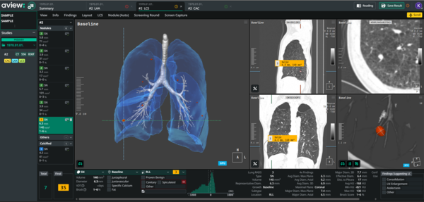코어라인소프트의 ‘AVIEW LCS Plus’ 3D 이미지. /코어라인소프트