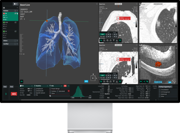코어라인소프트의 AVIEW LCS Plus 구동화면. /코어라인소프트