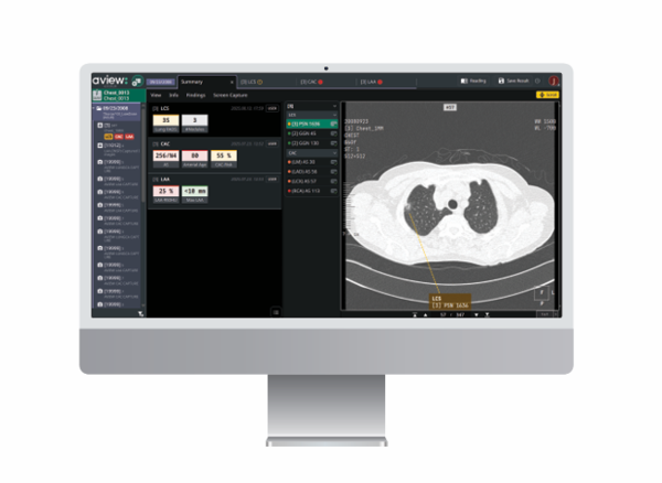 코어라인소프트의 에이뷰 2.0 서머리 페이지. /코어라인소프트